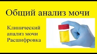 Общий анализ мочи ОАМ клинический анализ мочи [upl. by Omarr830]