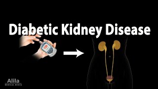 Diabetic Kidney Disease Animation [upl. by Salas]