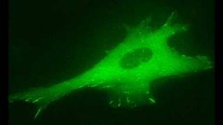 Actin Filament Induced Movement II Cell Adhesion [upl. by Novhaj]