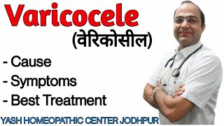 Varicocele Best Homeopathic treatment  Varicocele symptoms वरिकोसील का बिना सर्जरी ईलाज [upl. by Esyned286]