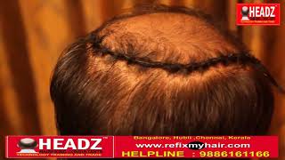 Hair Weaving in Chennai  Wig in Chennai Tamilnadu  Hair Patch for Men in Chennai Call 9087861166 [upl. by Katzen]