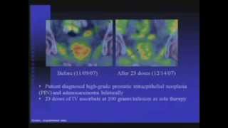 Interaction of IVC with Chemotherapeutic Agents [upl. by Inuat]