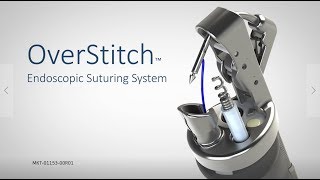 OverStitch™ Endoscopic Suturing System [upl. by Einaoj]