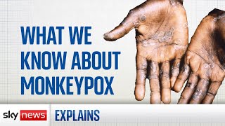 Monkeypox What you need to know [upl. by Hadwyn682]