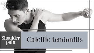 What is calcific tendinitis [upl. by Nairbal941]