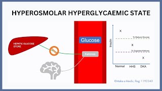 Hyperosmolar Hyperglycaemia State [upl. by Lanuk440]