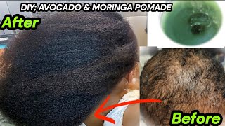 DIY HAIR GROWTH POMADE WITH AVOCADO MORINGA AND DOO GRO HAIR VITALIZER  2024 hair growth tips [upl. by Ljoka]