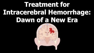 Treatment for Intracerebral Hemorrhage Dawn of a New Era [upl. by Grey428]