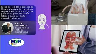 Lipotransferencia en Glúteos Rostro y Senos incluye factores de riesgo por el Doctor Edgar Terán [upl. by Kroo]