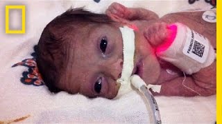 Born 4 Months Early This Tiny Survivor Beats the Odds  Short Film Showcase [upl. by Htebaras704]