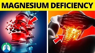 ⚡Top 10 Symptoms of Magnesium Deficiency BOOST Magnesium [upl. by Nady]