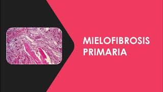 Neoplasias Mieloproliferativas [upl. by Paymar535]