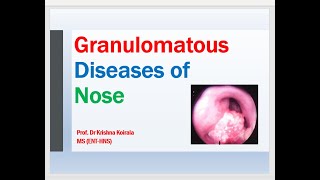 Granulomatous Diseases of Nose Dr Krishna Koirala Dr Krishnas ENT Lectures [upl. by Anoik77]