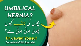 Umbilical hernia in babies What is umbilical hernia   Dr Jawad Yousuf [upl. by Joliet]