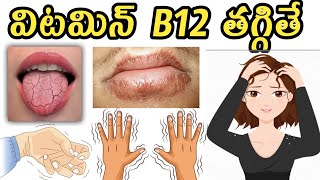 Low Vitamin B12 Symptoms in Teluguవిటమిన్ బి 12 [upl. by Newmann]