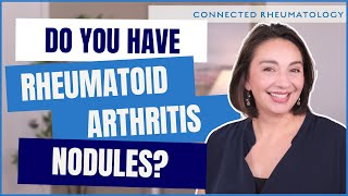 Surprise cause of Rheumatoid Arthritis nodules and everything else you need to know [upl. by Hammerskjold479]