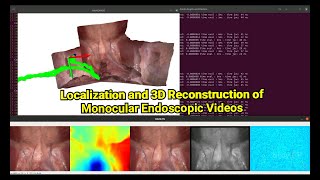 Localization and 3D Reconstruction of Monocular Endoscopic Videos [upl. by Akitahs]