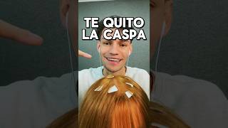 ￼TE QUITO LA CASPA asmr shorts asmrvideos comedia [upl. by Mairb]