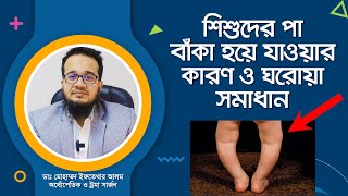 শিশুদের পা বাঁকা হয়ে যাওয়ার কারণ ও ঘরোয়া সমাধান। [upl. by Davison591]