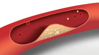 Blood Pressure Animation  Heart disease risk factors [upl. by Vedis]