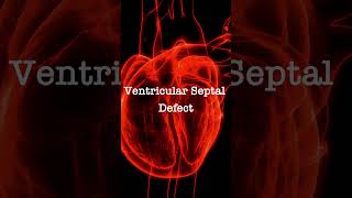 Normal Heart Sounds vs Ventricular Septal Defect Murmur [upl. by Barton]