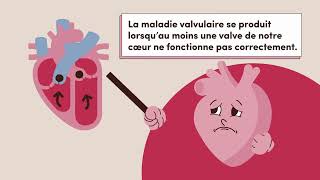 Semaine de sensibilisation aux maladies valvulaires 2024 [upl. by Selbbep535]