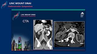 Visceral and Renal Focal Dissections Etiology and Treatment Options [upl. by Eirelam]