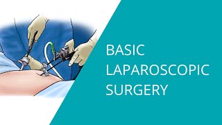 Basic Laparoscopic Surgery [upl. by Blondie]