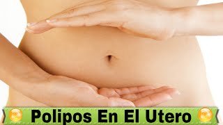 Polipos En El Utero Remedios Naturales Para Polipos En El Utero [upl. by Nojid]