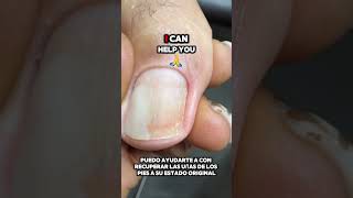 Foot Care Relief schedule a consultation httpstheglobalmanicuristasmeNailPro reliefpedicure [upl. by Iegres]