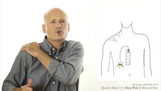 Chest Pain 3 Referred pain [upl. by Chaddy]