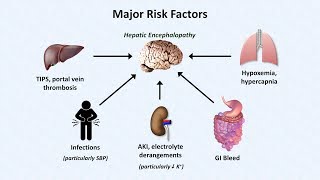 Hepatic Encephalopathy [upl. by Derfliw283]