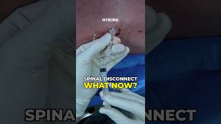 Spinal Disconnect What now spinal anesthesia disconnect [upl. by Snowman]