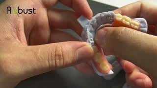 Cast Partial Denture Quality Control What is a good Cast Partial Denture [upl. by Eilyw]