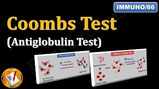 Coombs test or Antiglobulin Test FLImmuno66 [upl. by Ylro341]