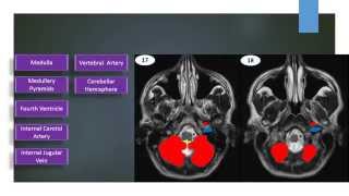 MRI Brain Sectional Anatomy Cut 17 amp 18 [upl. by Larine]