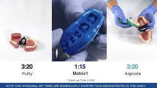 Fast Fabricating of Provisionals Using Matrix1 from Brasseler USA [upl. by Stedt]