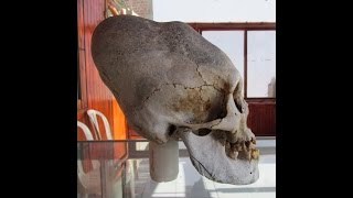 Newly Discovered Elongated Skulls In Paracas Peru [upl. by Sletten81]