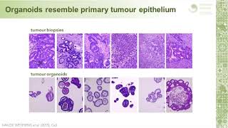 Investigating colorectal cancer using epithelial organoid cultures [upl. by Melantha825]