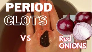 Can Onions Really Treat Menstrual Disorders  PCOS Period Clots Irregular Cycle [upl. by Wrench]