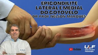 EPICONDILITE MEDIAL e LATERAL DO COTOVELO  Dr Prof Nelson Marques [upl. by Natty]