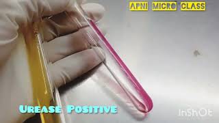 Urease test In Microbiology lab  How to read  Positive Urease reaction [upl. by Riek]