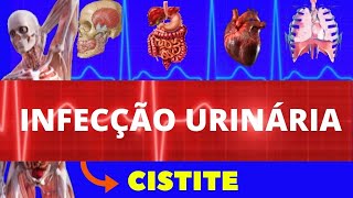 CISTITE  INFECÇÃO URINÁRIA  SINTOMAS DIAGNÓSTICO E TRATAMENTO  INFECÇÃO DA BEXIGA  TRATAMENTO [upl. by Novihc817]