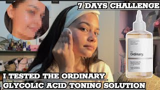 7 Days Challenge I Tested The Ordinary Glycolic Acid Toner For A Week  The Ordinary Skincare Review [upl. by Ignatz]