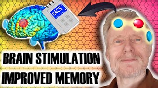 Improved Memory By Using Transcranial Alternating Current Stimulation  Neuro3 [upl. by Onfre]