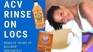 ACV RINSE ON LOCS😱😍 FIRST TIME RESULTS  HIGHLY RECOMMEND [upl. by Wanda241]