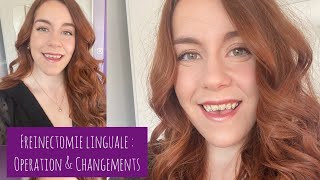 Freinectomie Linguale  Opération amp Changements [upl. by Ranit]