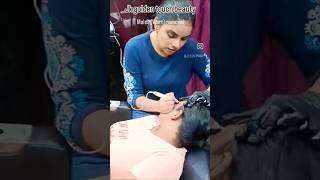 Wart removal music newvideo youtubeshorts moles [upl. by Rabka49]