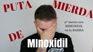 9º Meses con MINOXIDIL PUTA MIERDA DE MINOXIDIL [upl. by Hosfmann]