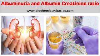 Albuminuria  Albumin Creatinine Ratio  Albumin In Urine [upl. by Odrude]